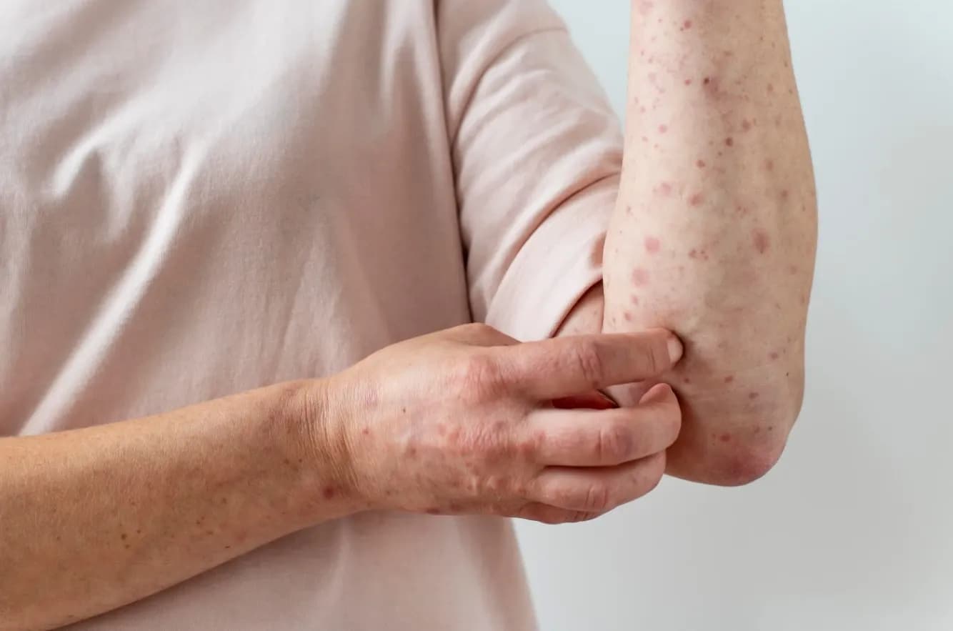 Dermatolog Poznań – konsultacje i leczenie